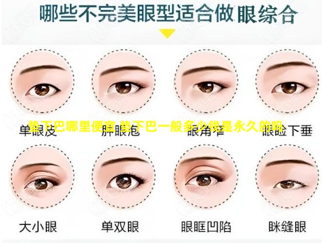 垫下巴哪里便宜 垫下巴一般多少钱是永久的吗
